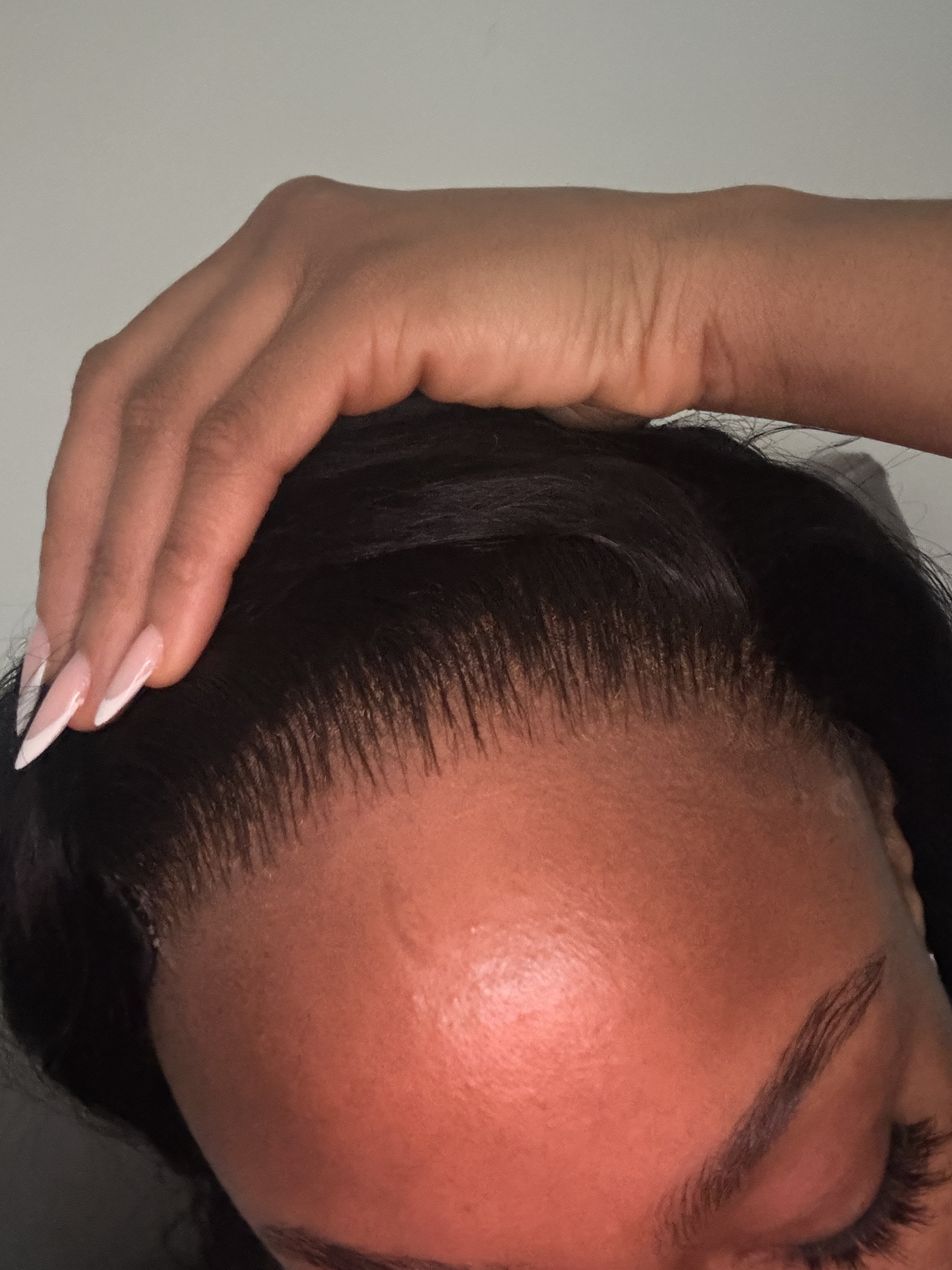 Closures and frontals